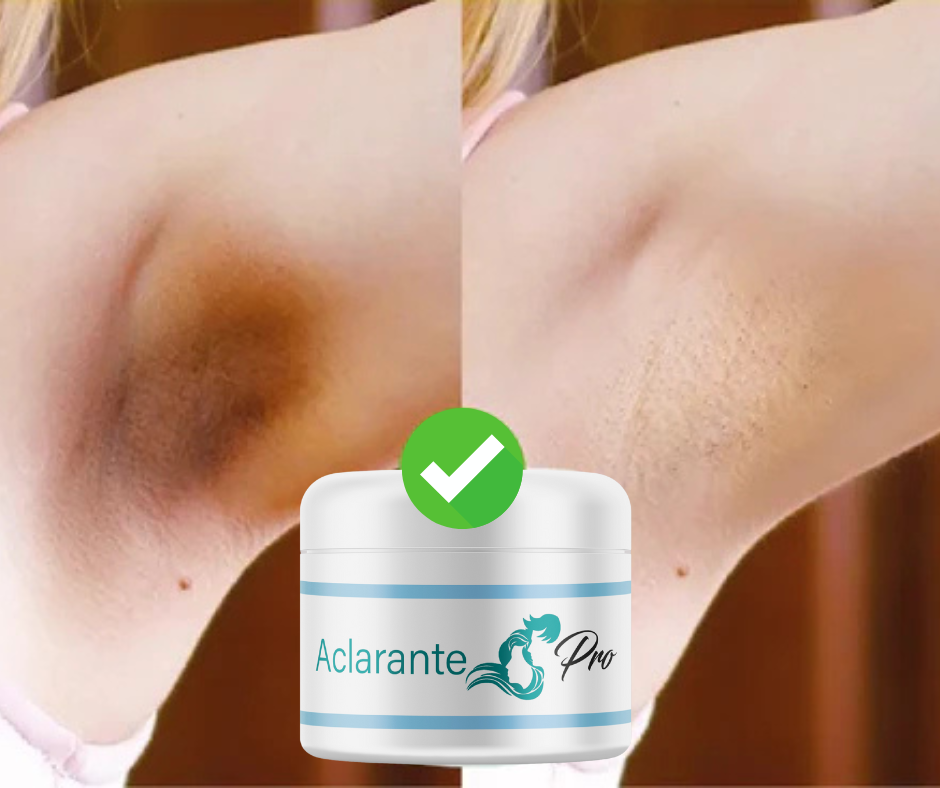 2x1 Crema Aclaradora PRO+ENVIO GRATIS A TODA GUATEMALA 📦